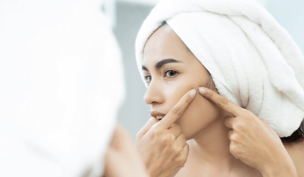 Battling Breakouts: A Comprehensive Guide to Acne